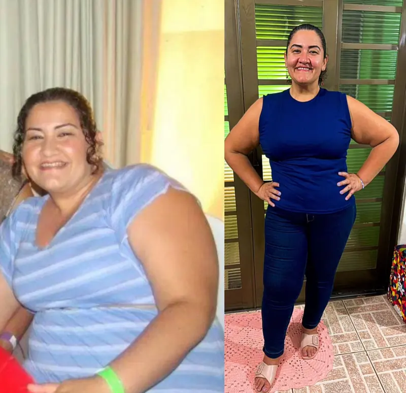 Resultado real de aluna do Protocolo Canetinha